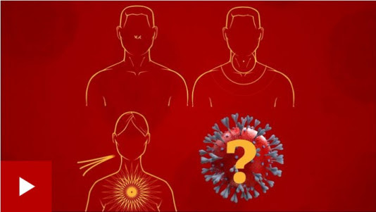 A cold, flu or coronavirus – which one do I have? (BBC News)