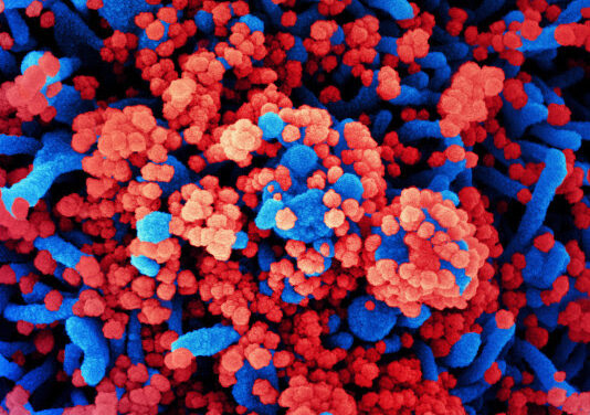 How COVID-19 Attacks The Brain And May Cause Lasting Damage