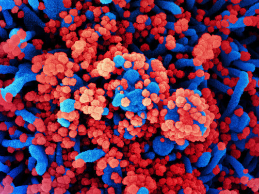 How COVID-19 Attacks The Brain And May Cause Lasting Damage